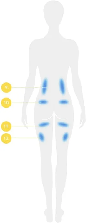 Back body diagram with numbered treatable fat areas for CoolSculpting fat freezing in London