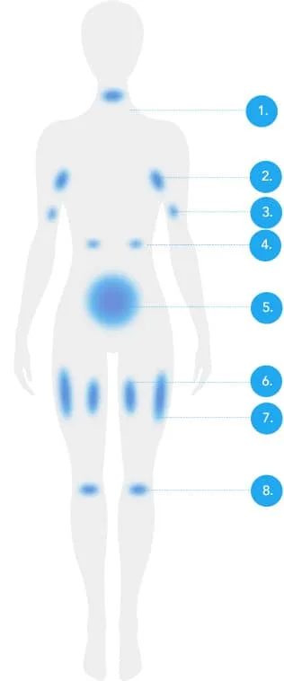 Front body diagram with numbered treatable fat areas for CoolSculpting fat freezing in London