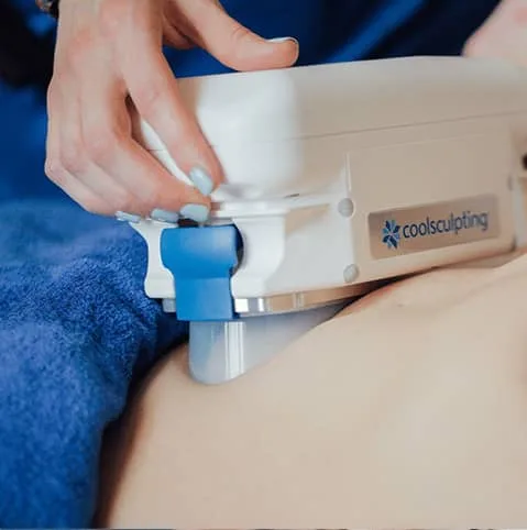Hands fitting a fat freezing applicator to a patient's abdomen at Cool Clinic, CoolSculpting fat freezing London